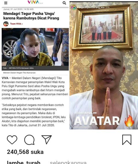 Pasha 'Ungu' kini berkepala plontos (foto: instragram)